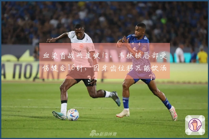 血染首战两度破门，韦林顿唇部受伤缝合15针，因牙齿位移只能饮汤